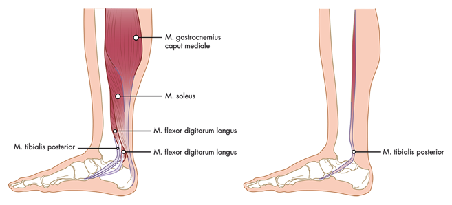 fig_2e